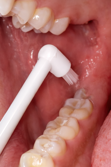 Brushwise 'EZ Reach' End Tuft Brush